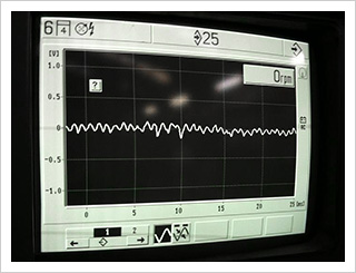 オシロスコープによる充電・点火・信号波形の点検　波形信号波形の点検
